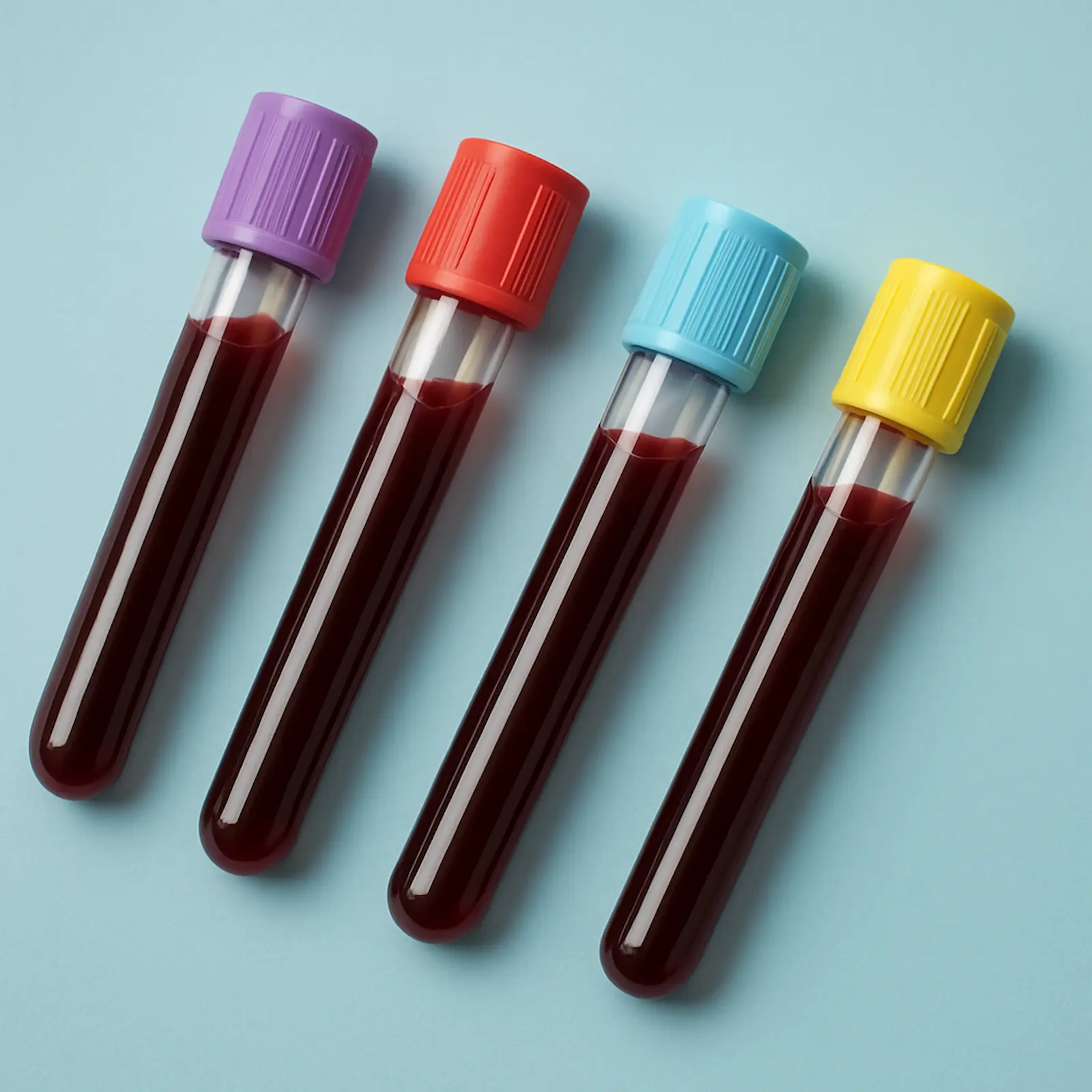 Blood samples prepared for iron profile testing